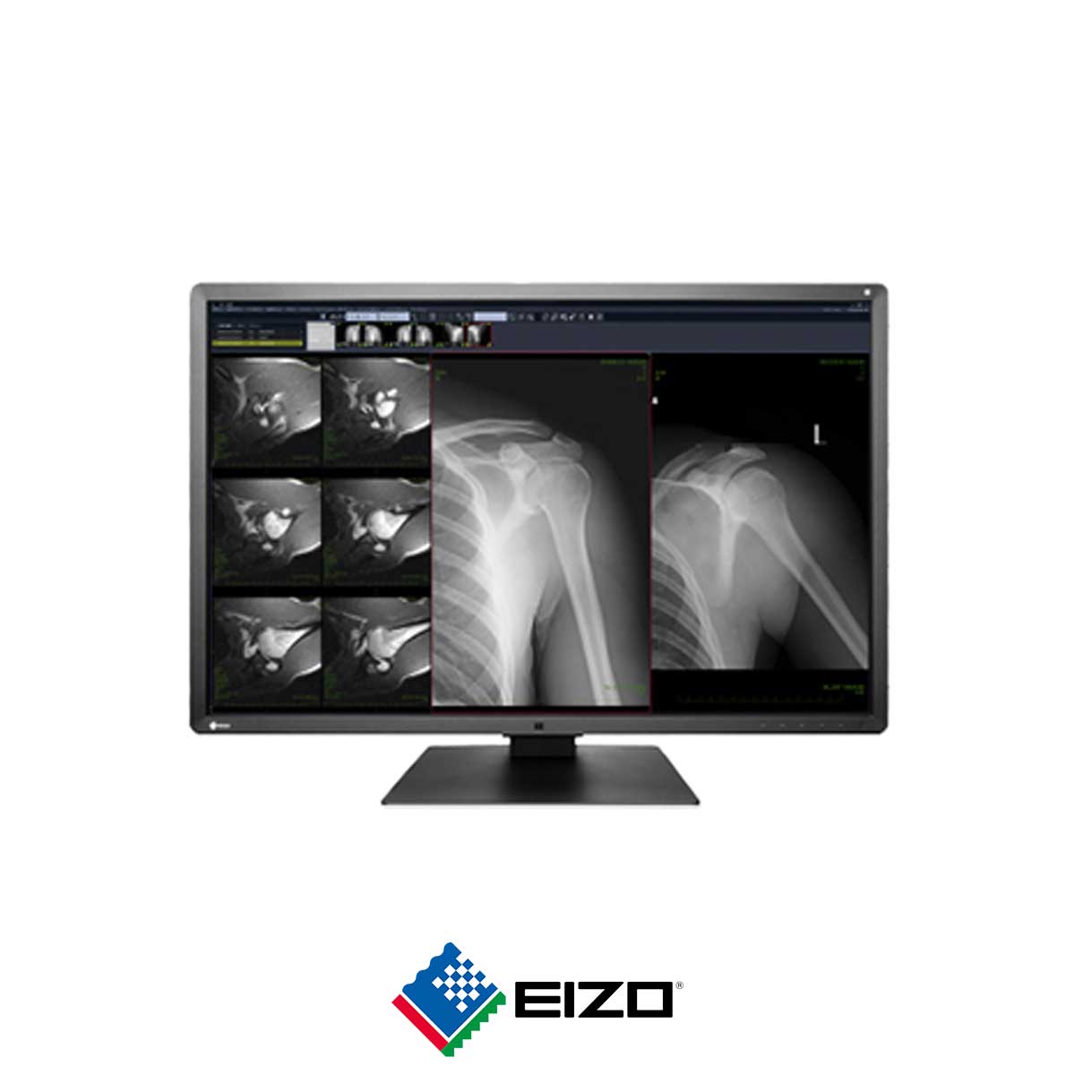 80.EIZO-RadiForce-RX660