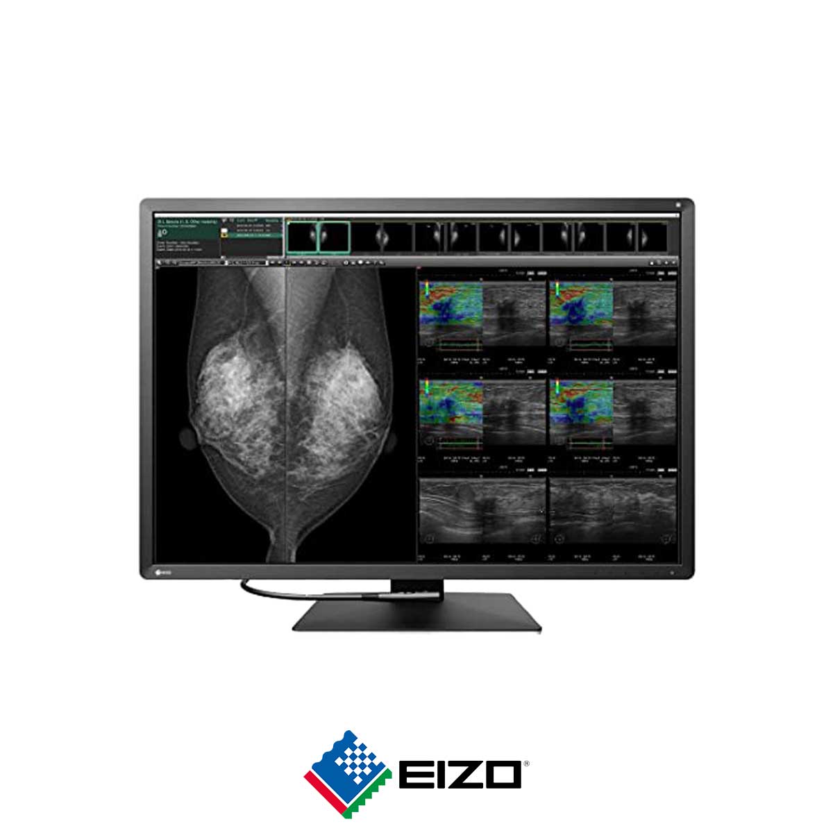 83.EIZO-RadiForce-RX1270