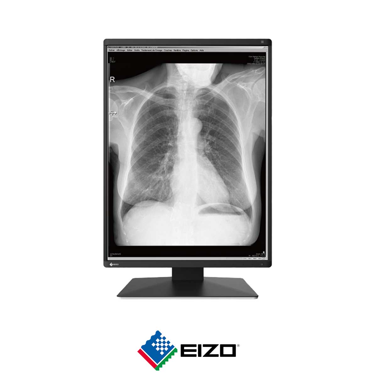 85.EIZO-RadiForce-RX370
