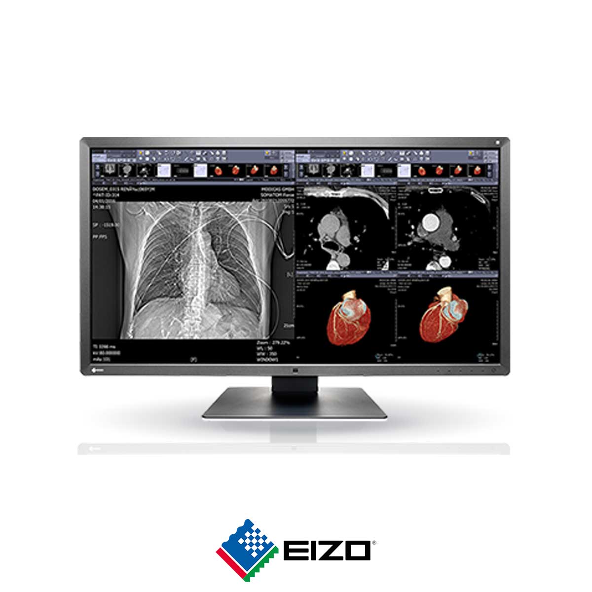 86.EIZO-RadiForce-MX315W