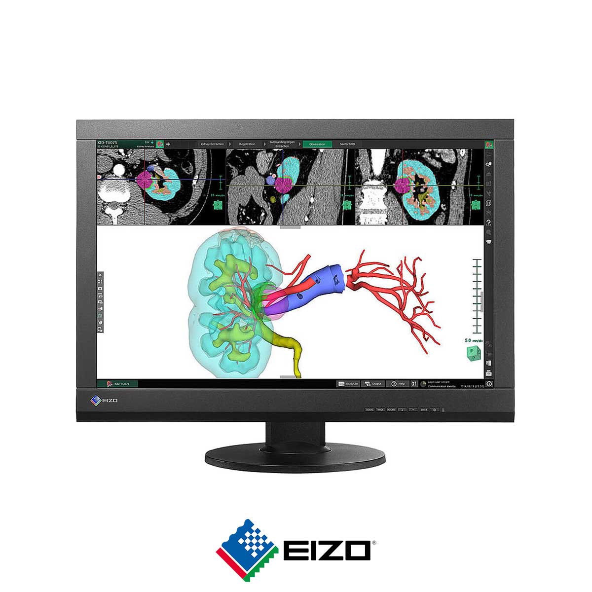 87.EIZO-RadiForce-MX242W
