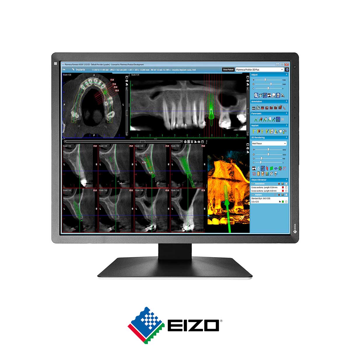 88.EIZO-RadiForce-MX216-SB