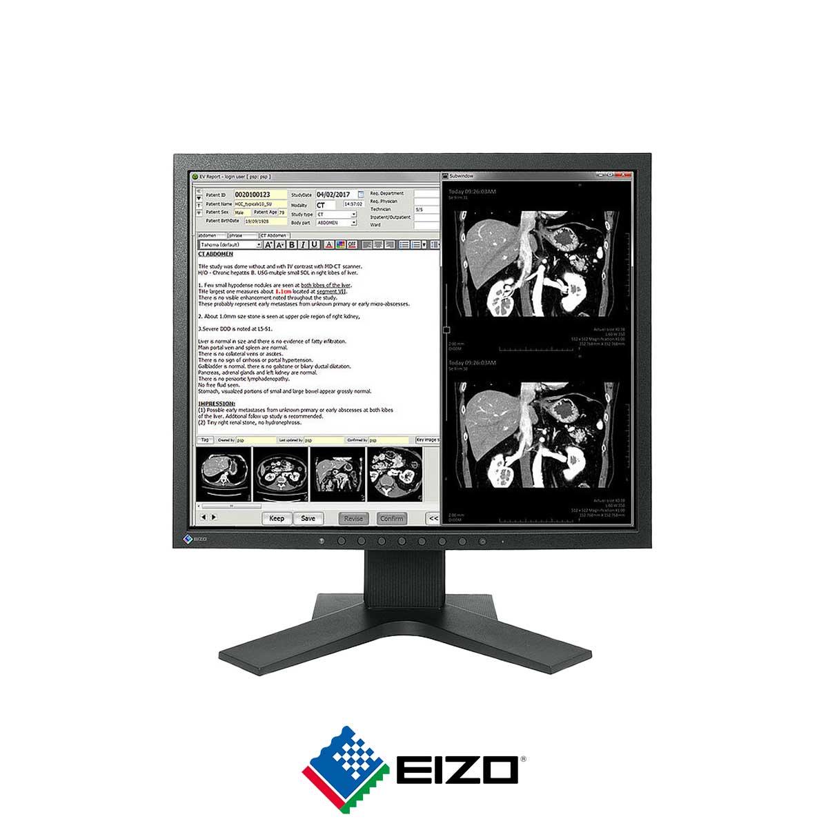 89.EIZO-RadiForce-MX194