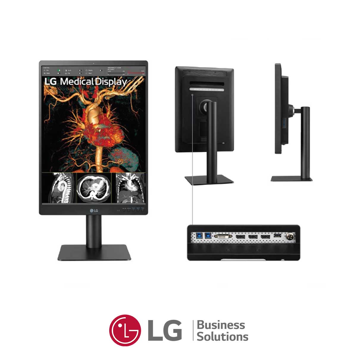 106.LG-21HQ513D-Monitor-diagnostico