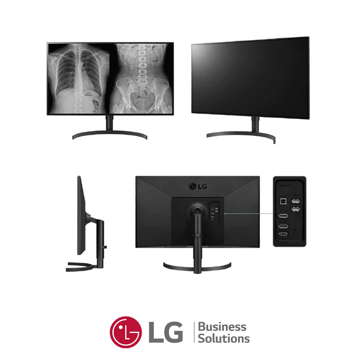 107.LG-32HL512D-Monitor-Diagnostico