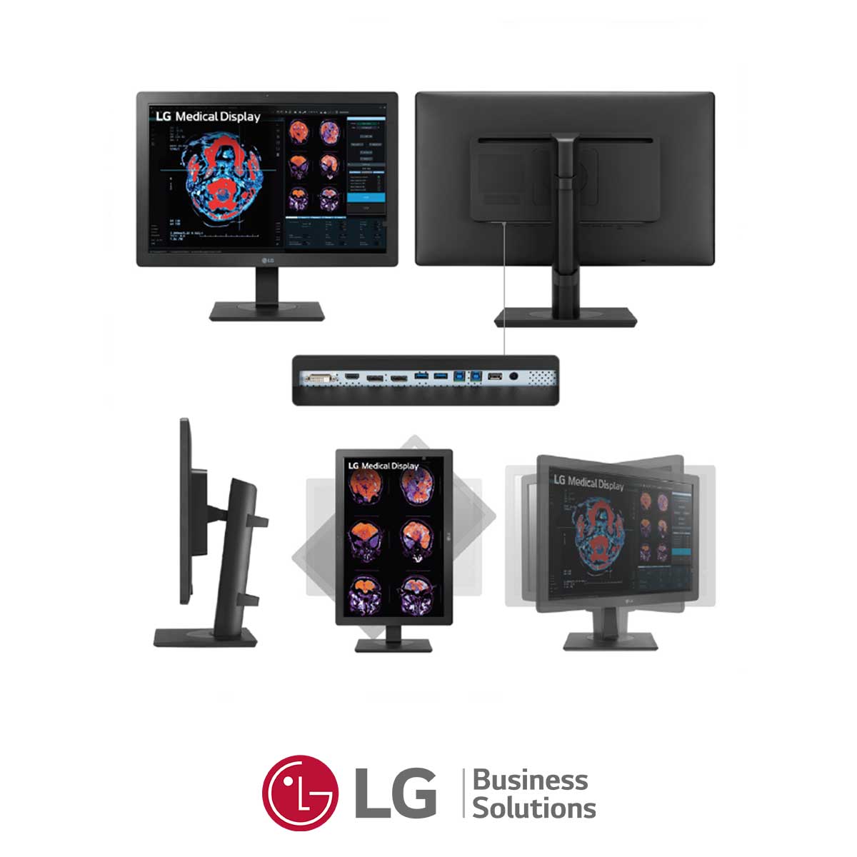 109.LG-24HR513C-monitor-clinico