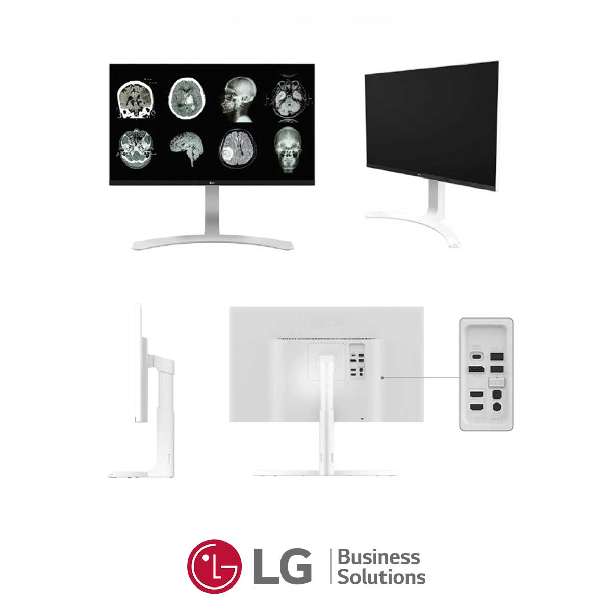 110.LG-27HJ712C-monitor-clinico