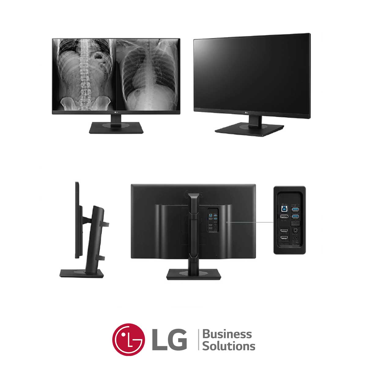 111.LG-27HJ713C-monitor-clinico